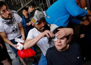 Heridos oculares,priotestas chile. Foto agencias.