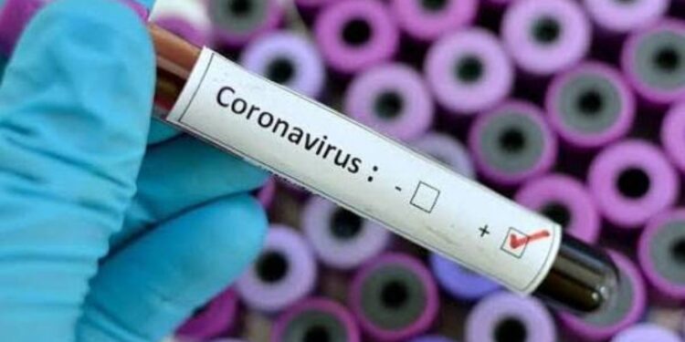 Cornavirus. Foto de archivo.