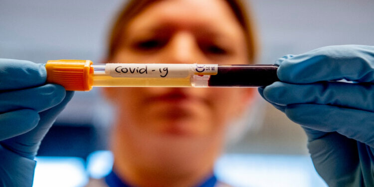 BREDA, NETHERLANDS - 2020/03/20: A lab technician holding a test tube that contains blood sample from a patient that has tested positive with the COVID-19 coronavirus at Amphia Hospital.
The Amphia Hospital is currently carrying out between 400-500 tests a day for suspected cases of the COVID-19 Coronavirus. Coronavirus testing are to patients free of charge in the Netherlands. (Photo by Robin Utrecht/SOPA Images/LightRocket via Getty Images)