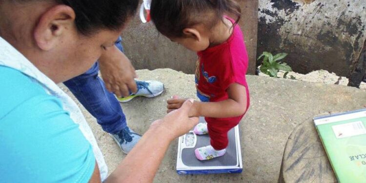 Desnutrición infantil. Venezuala. Foto agencias.