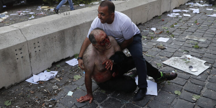 A Lebanese man helps an injured person who was wounded by an explosion that hit the seaport, in Beirut Lebanon, Tuesday, Aug. 4, 2020. (AP Photo/Hussein Malla)