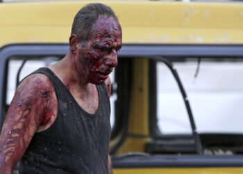 EDITORS NOTE: Graphic content / A wounded man walks at the port near the scene of an explosion in the Lebanese capital Beirut on August 4, 2020. - Two huge explosion rocked the Lebanese capital Beirut, wounding dozens of people, shaking buildings and sending huge plumes of smoke billowing into the sky. Lebanese media carried images of people trapped under rubble, some bloodied, after the massive explosions, the cause of which was not immediately known. (Photo by ANWAR AMRO / AFP)