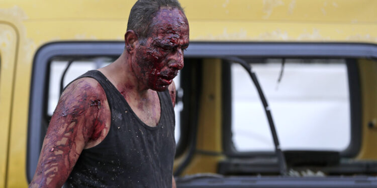 EDITORS NOTE: Graphic content / A wounded man walks at the port near the scene of an explosion in the Lebanese capital Beirut on August 4, 2020. - Two huge explosion rocked the Lebanese capital Beirut, wounding dozens of people, shaking buildings and sending huge plumes of smoke billowing into the sky. Lebanese media carried images of people trapped under rubble, some bloodied, after the massive explosions, the cause of which was not immediately known. (Photo by ANWAR AMRO / AFP)