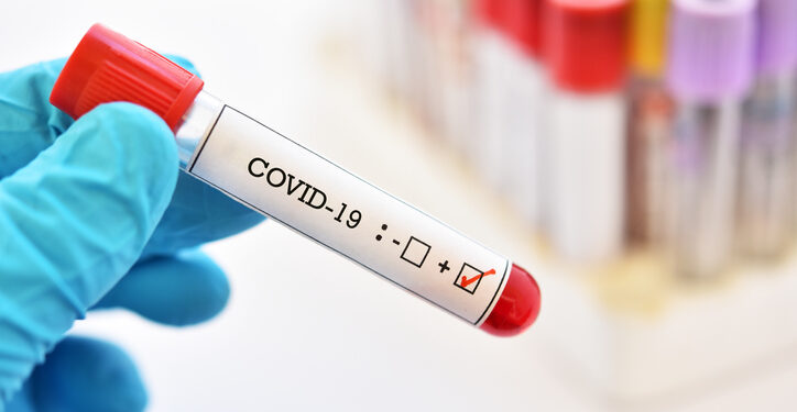 Blood sample tube positive with COVID-19 or novel coronavirus 2019 found in Wuhan, China
