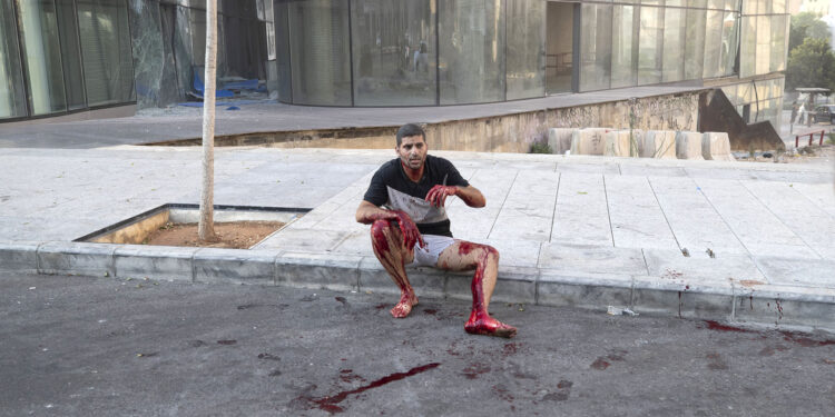 A wounded man sits on a sidewalk after a massive explosion in in Beirut, Lebanon, Tuesday, Aug. 4, 2020. Massive explosions rocked downtown Beirut on Tuesday, flattening much of the port, damaging buildings and blowing out windows and doors as a giant mushroom cloud rose above the capital. Witnesses saw many people injured by flying glass and debris. (AP Photo/Hassan Ammar)