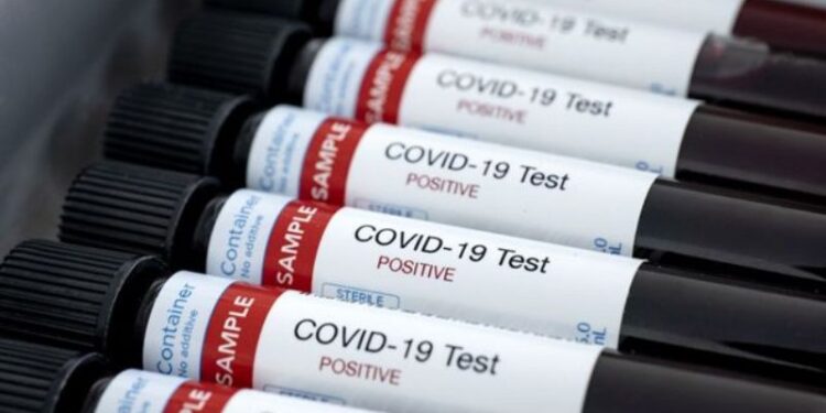 Coronavirus, Test. Foto de archivo.
