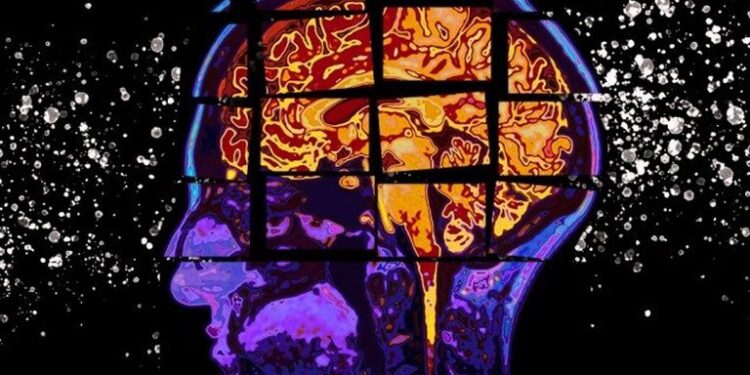 Expertos temen que si la droga para Alzheimer es aprobada por la FDA se bajen los estándares para el futuro. Ya que faltaría más investigación sobre los beneficios y los riesgos de la droga aducanumab para tratar el deterioro cognitivo del cerebro/CHRISTINE DANILOFF, MIT