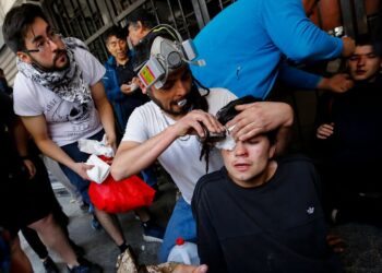 Chile, protestas, traumatismos oculares. Foto agencias.
