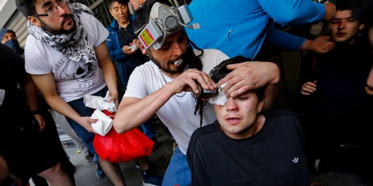 Chile, protestas, traumatismos oculares. Foto agencias.