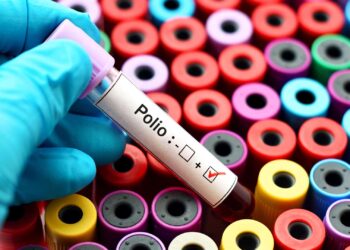 Blood sample positive with polio virus.
