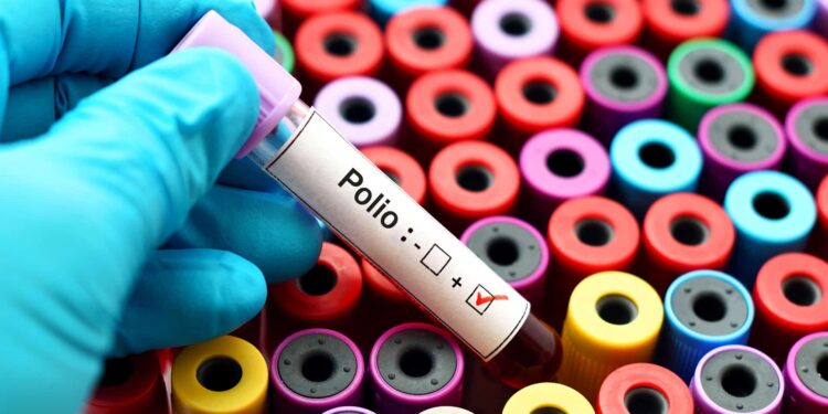 Blood sample positive with polio virus.