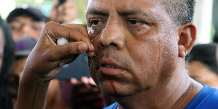 Un migrante se cose la boca durante una protesta hoy, en la ciudad de Huixtla, estado de Chiapas (México). Algunos integrantes del “Viacrucis migrante", que avanza por el sureste de México integrado por 3.500 personas, se suturaron este martes los labios como medida de presión y de protesta para presionar a las autoridades Instituto Nacional de Migración (INM) para que sean atendidas sus exigencias de obtener documentos migratorios. EFE/ Juan Manuel Blanco